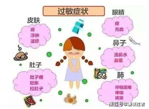 怀孕期间食物过敏症状