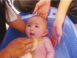 预防婴儿沐浴时的皮肤问题有哪些