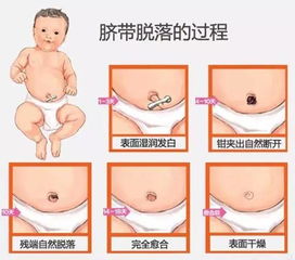 新生儿脐带护理常规内容