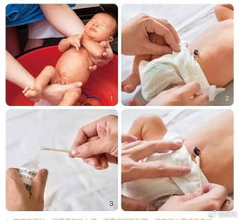 新生儿脐带护理应选用什么消毒