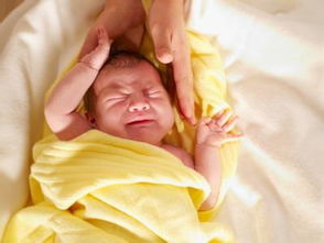 新生儿黄疸如何观察与护理