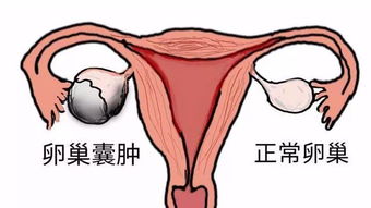 生育年龄的女性正常卵巢多大