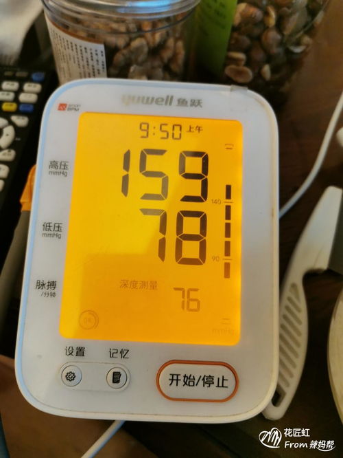 孕期血压监测付费680贵吗