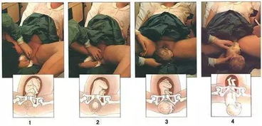 分娩的过程分为三个时期