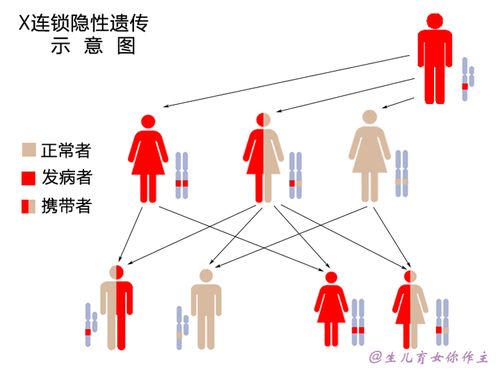 遗传病能看好吗