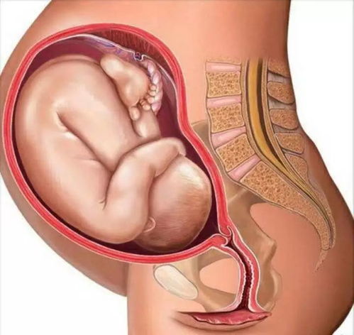 刺激胎儿出生的方法