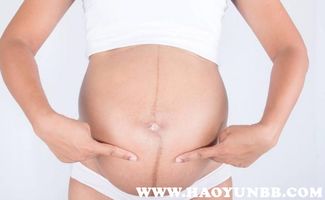 怀孕期间怎样防止妊娠纹的出现